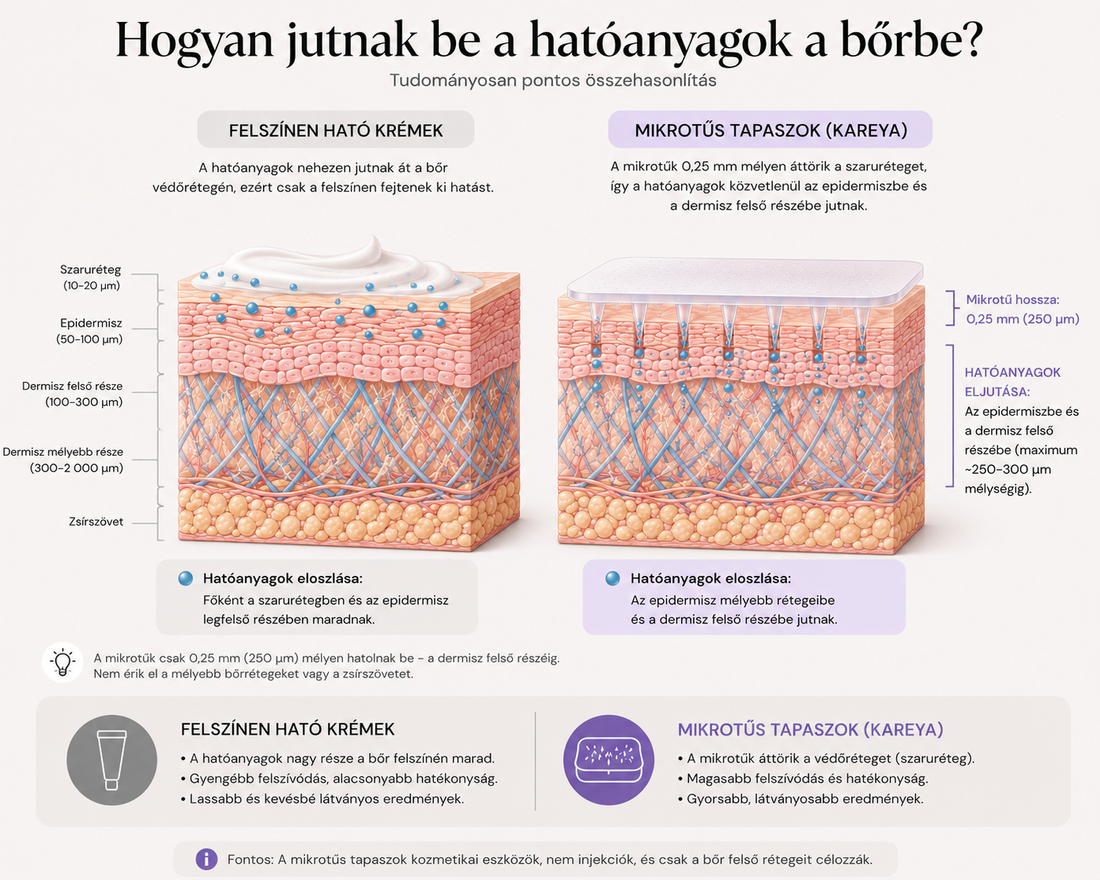 Szemkörnyéki ráncok: miért nem elég a krém, és mit tehet a mikrotűs tapasz?