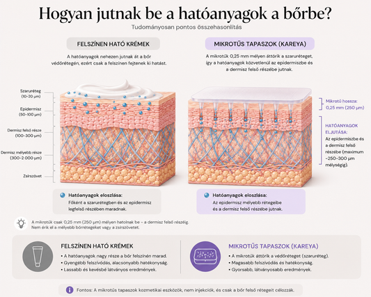 Szemkörnyéki ráncok: miért nem elég a krém, és mit tehet a mikrotűs tapasz?